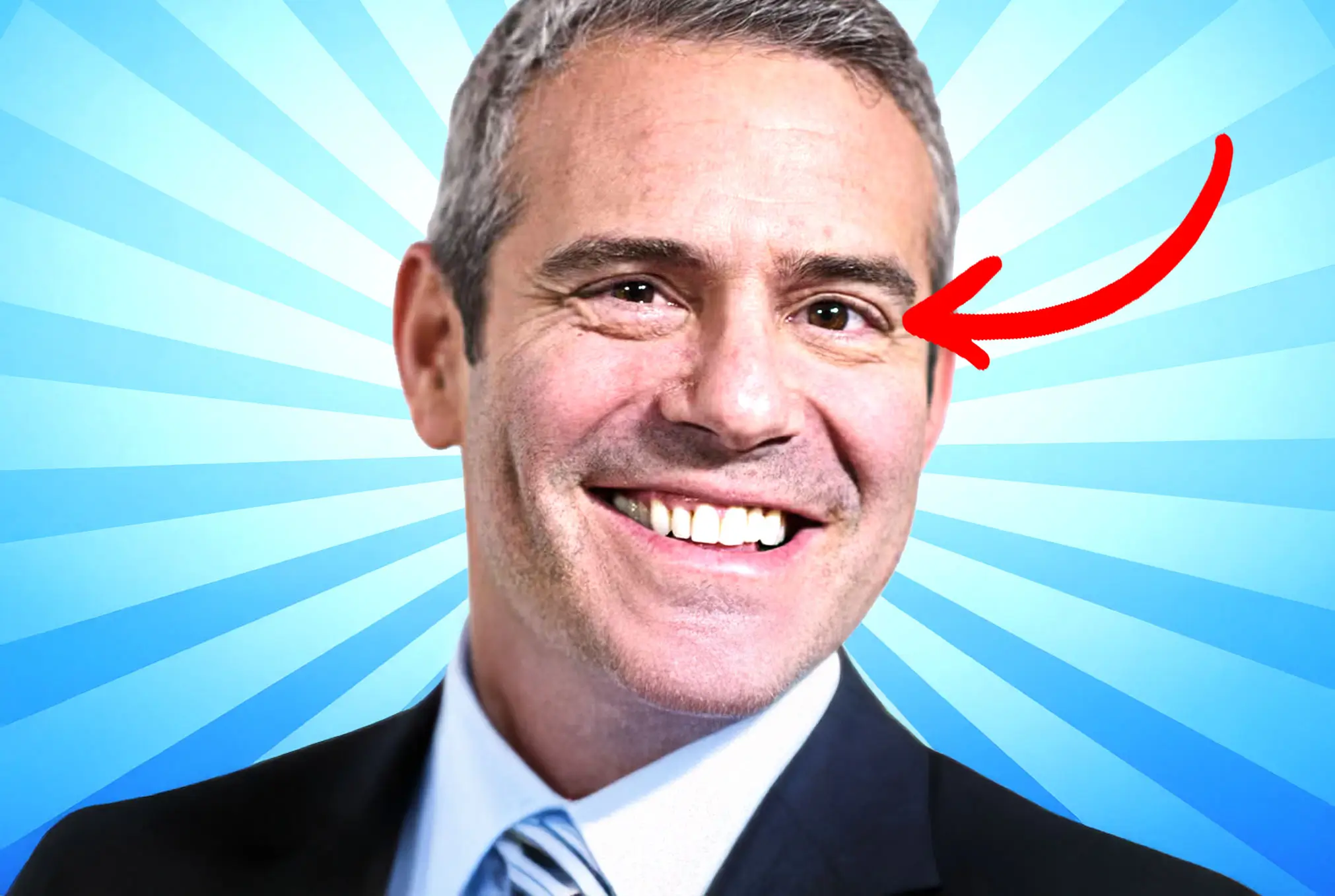 Andy Cohen lazy eye