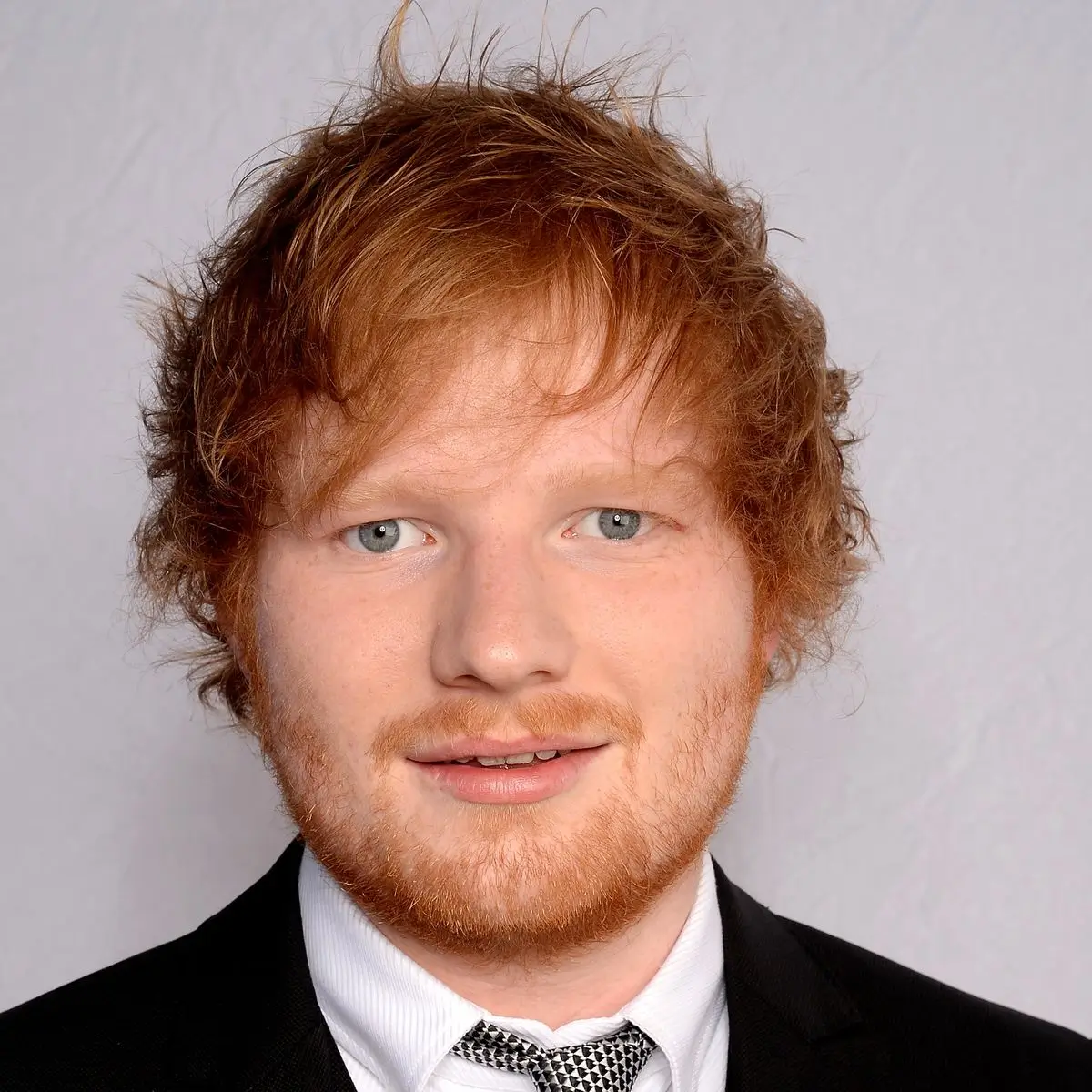 Before photo of Ed Sheeran