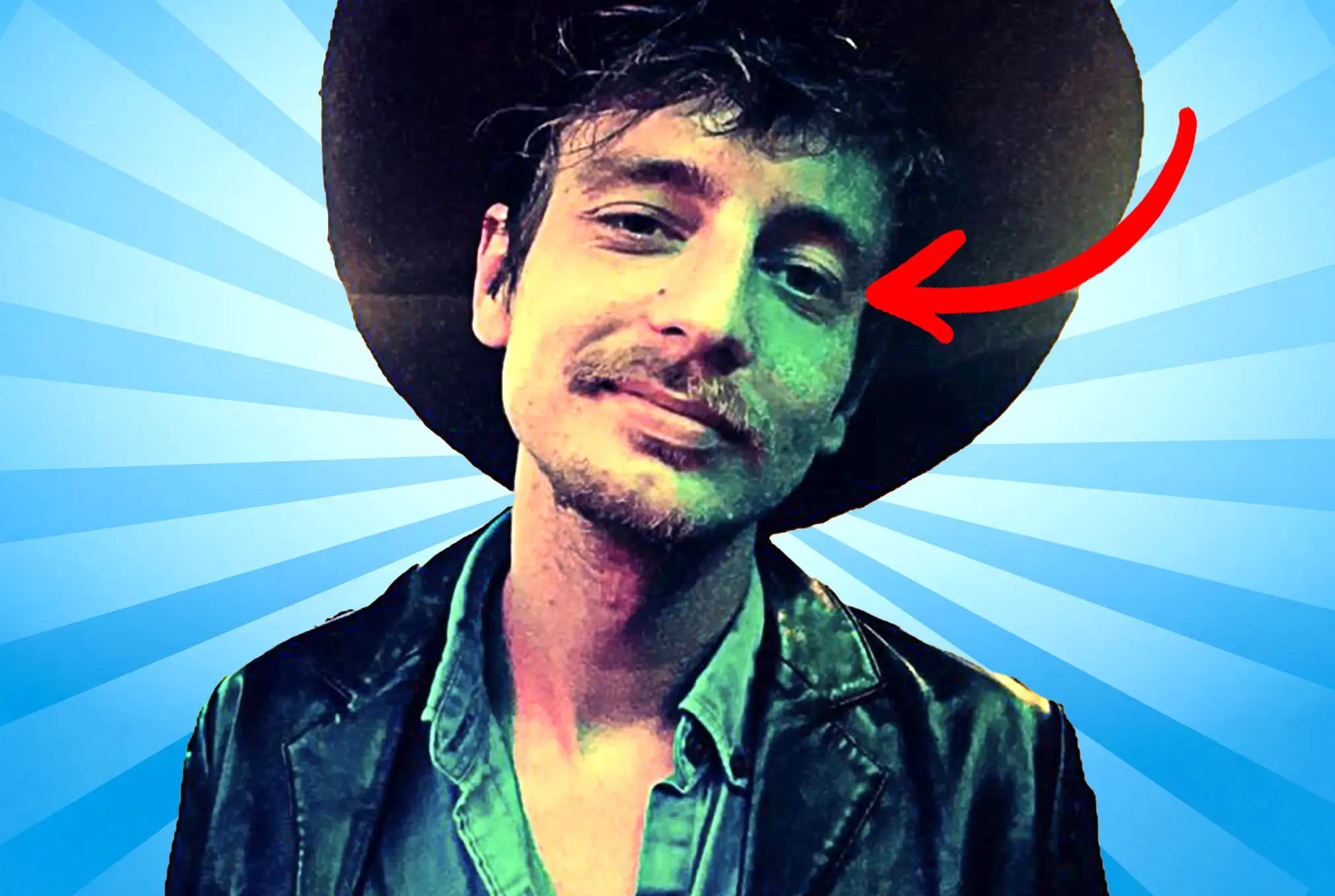 Dylan Wilson King Lazy Eye