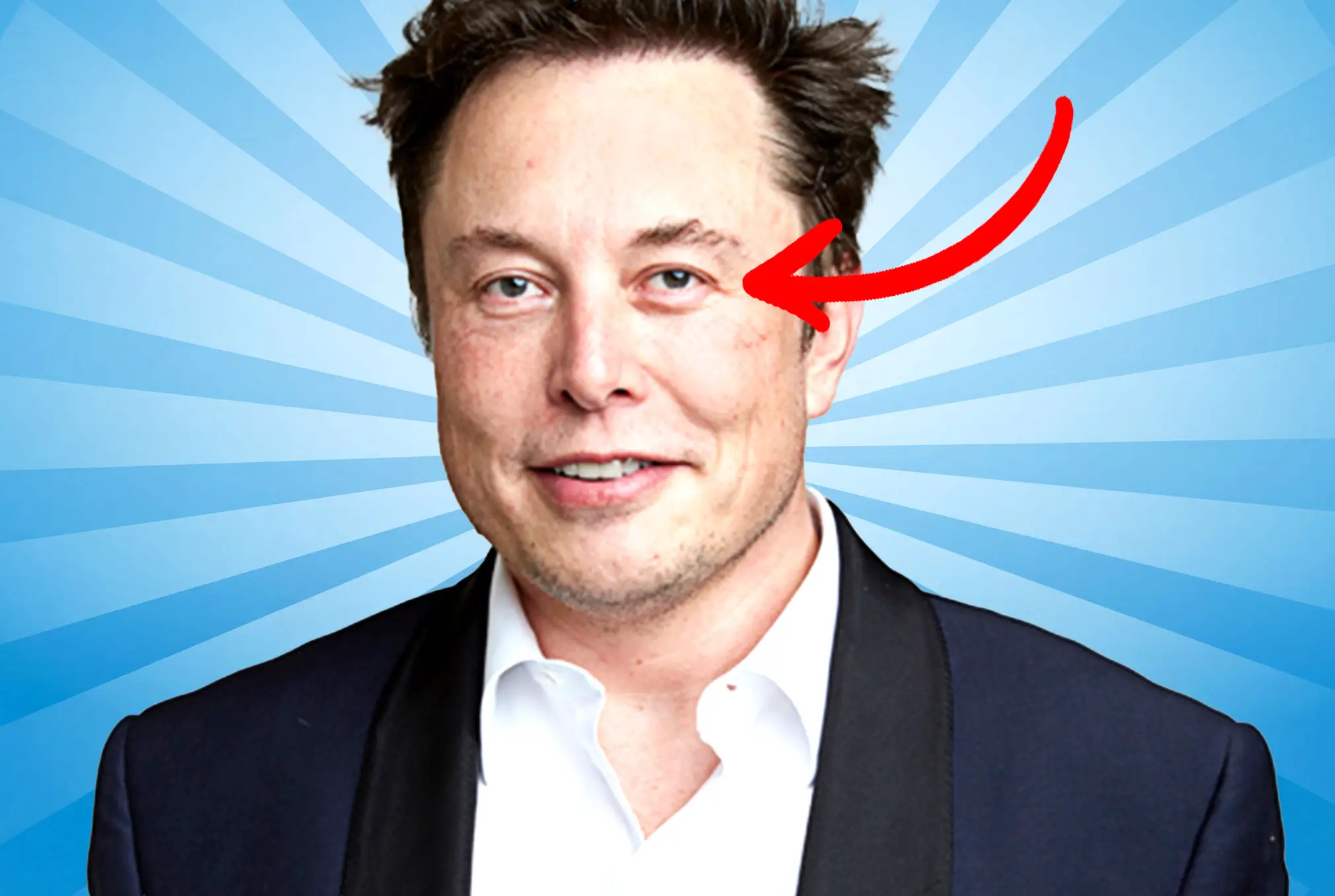 Elon Musk lazy eye