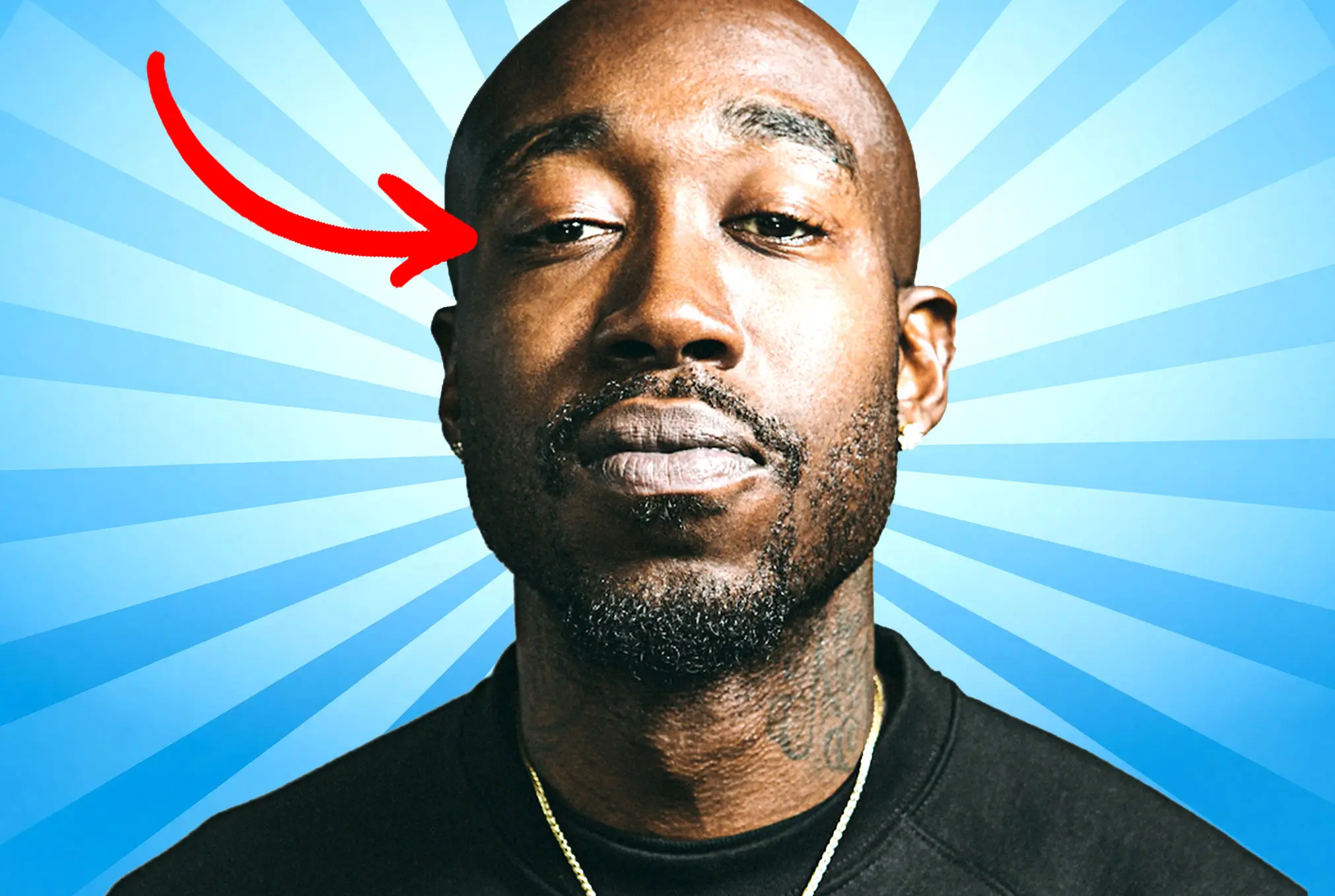 Freddie Gibbs lazy eye