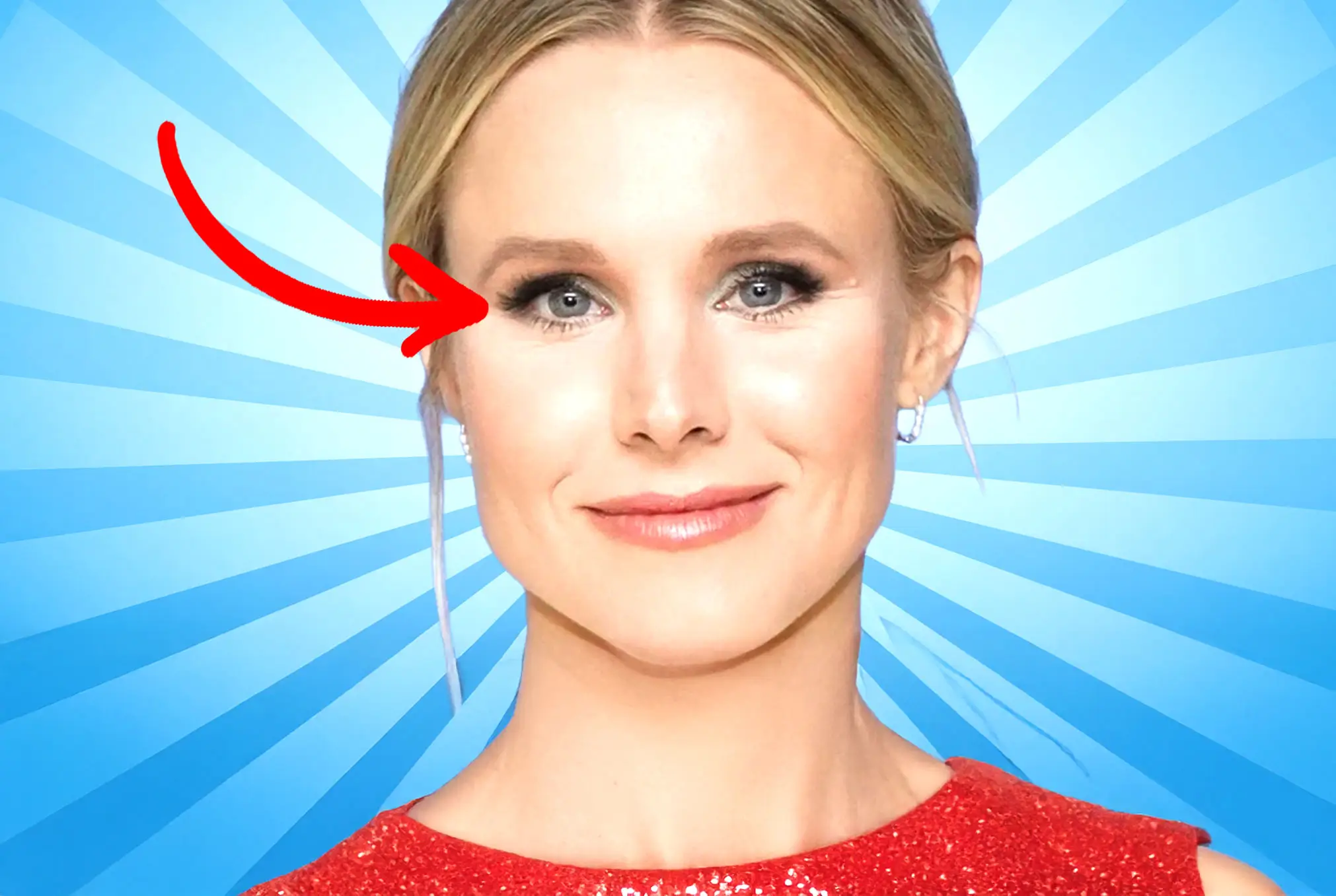 Kristen Bell lazy eye