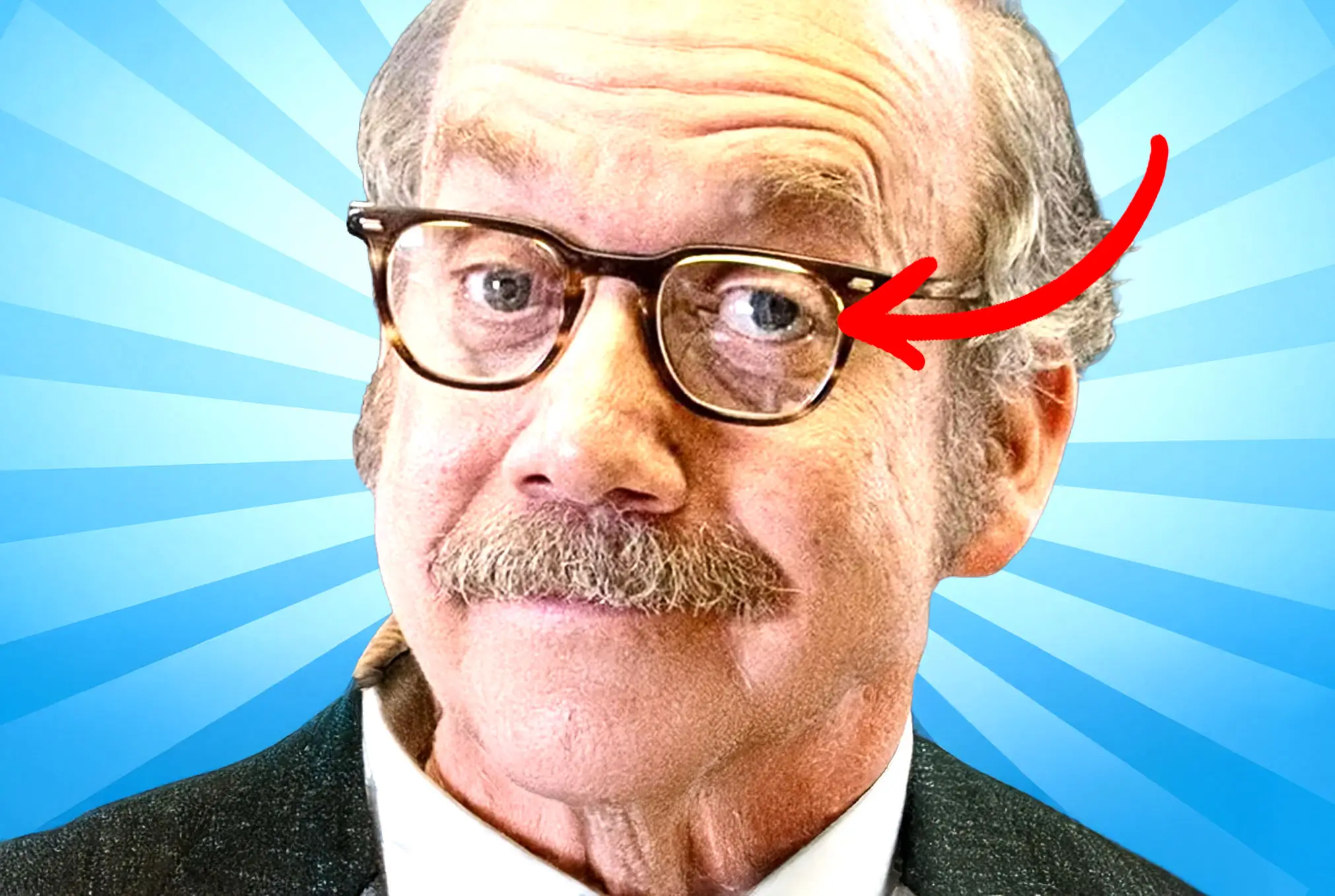 Paul Giamatti lazy eye