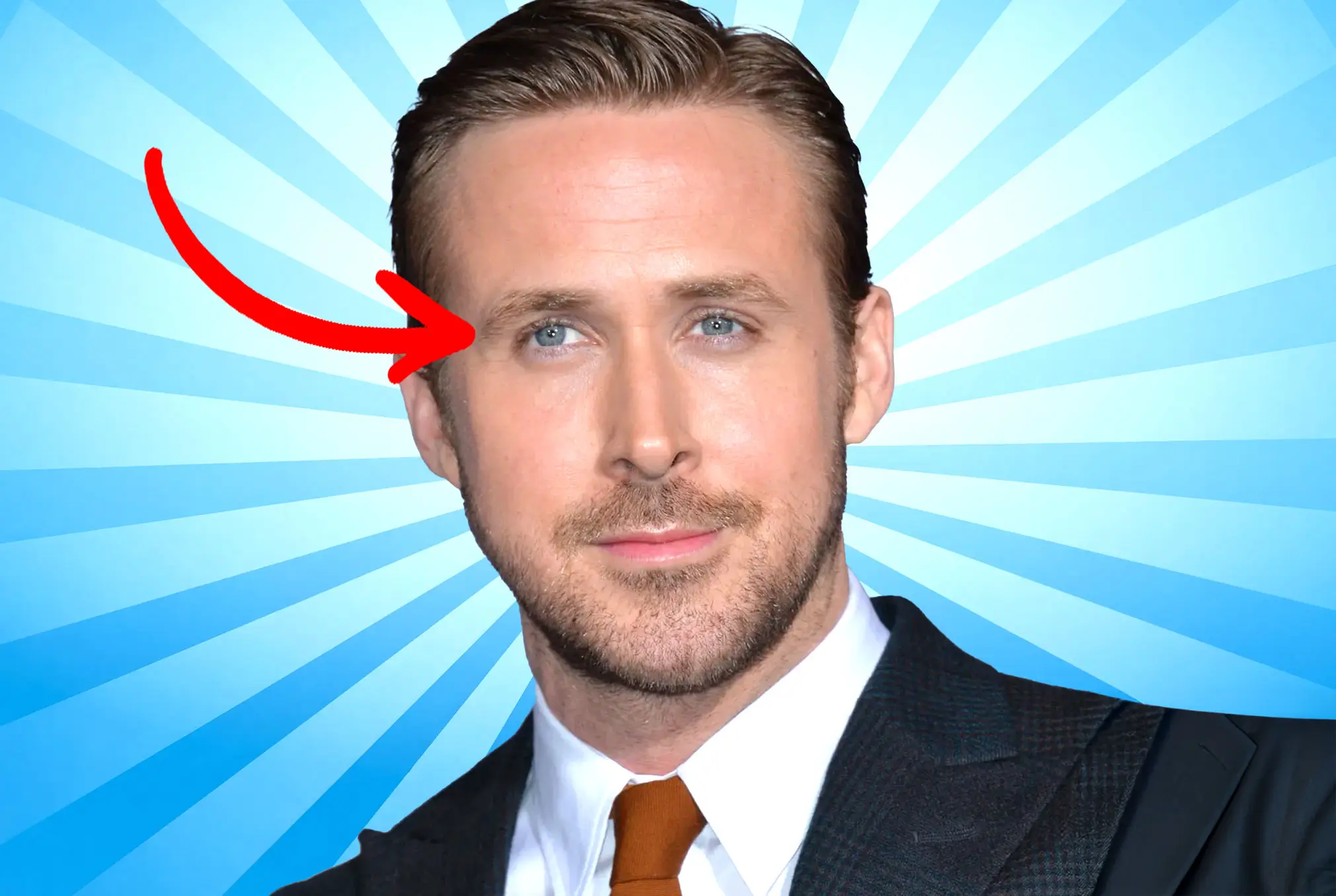 Ryan Gosling lazy eye