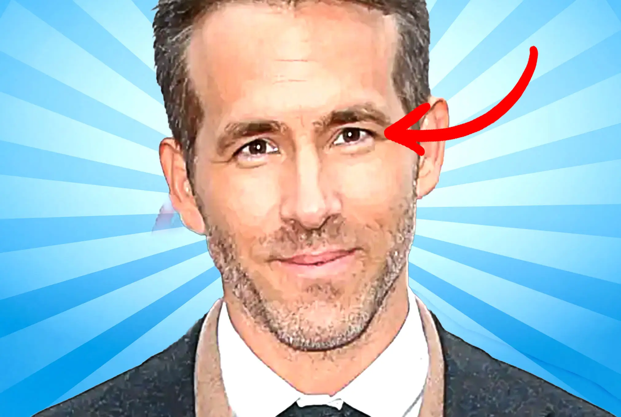 Ryan Reynolds lazy eye