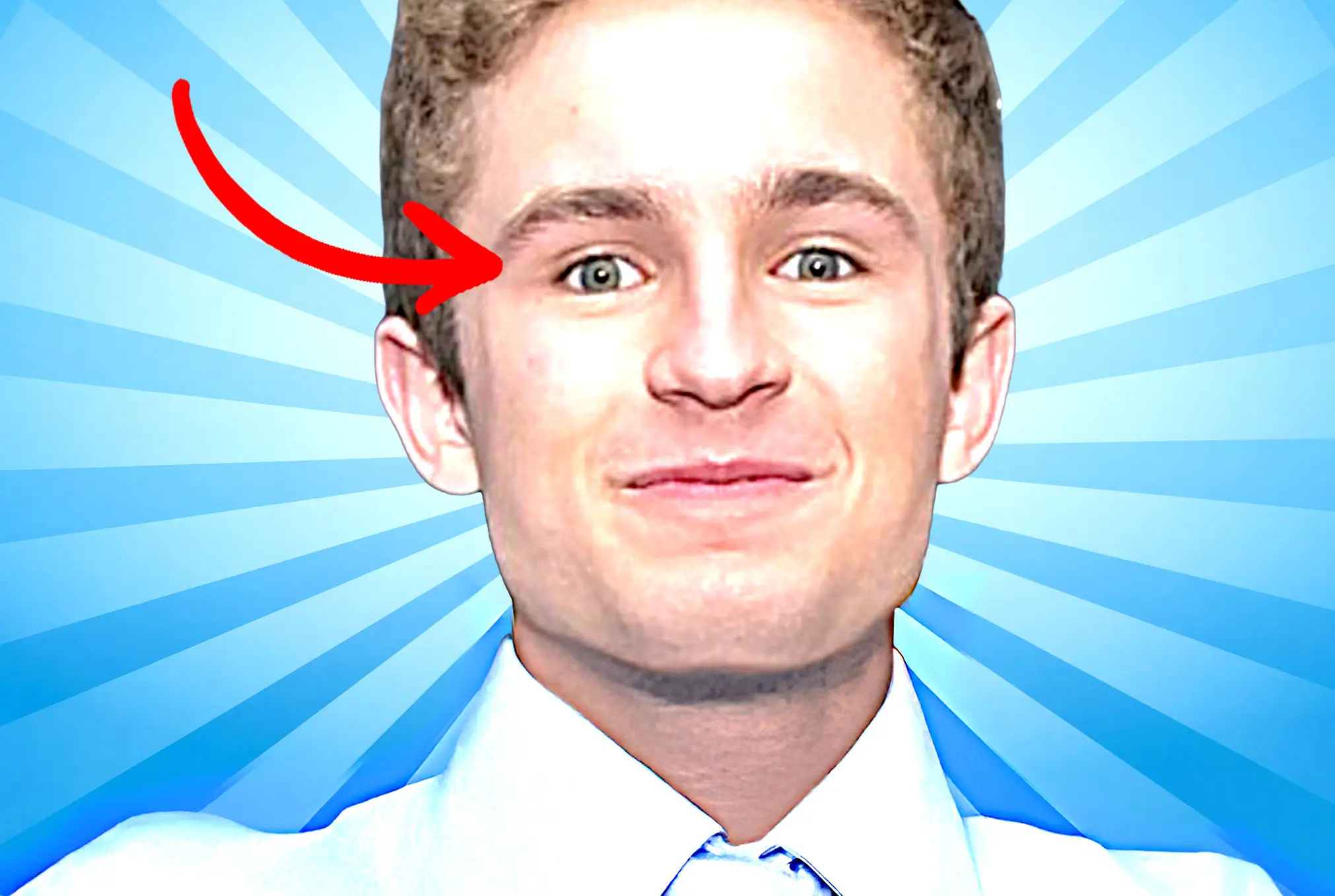 Sean Giambrone lazy eye