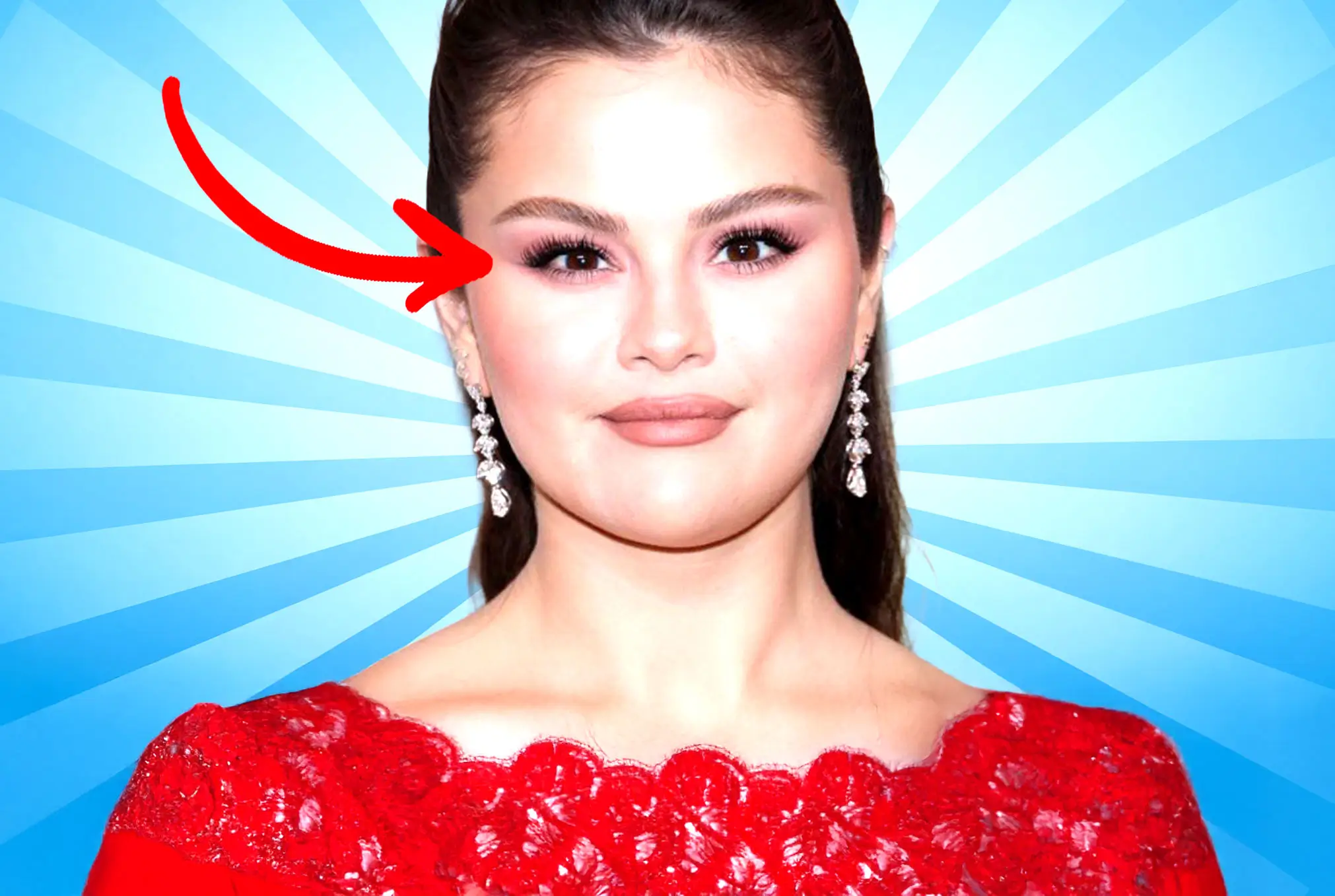 Selena Gomez lazy eye