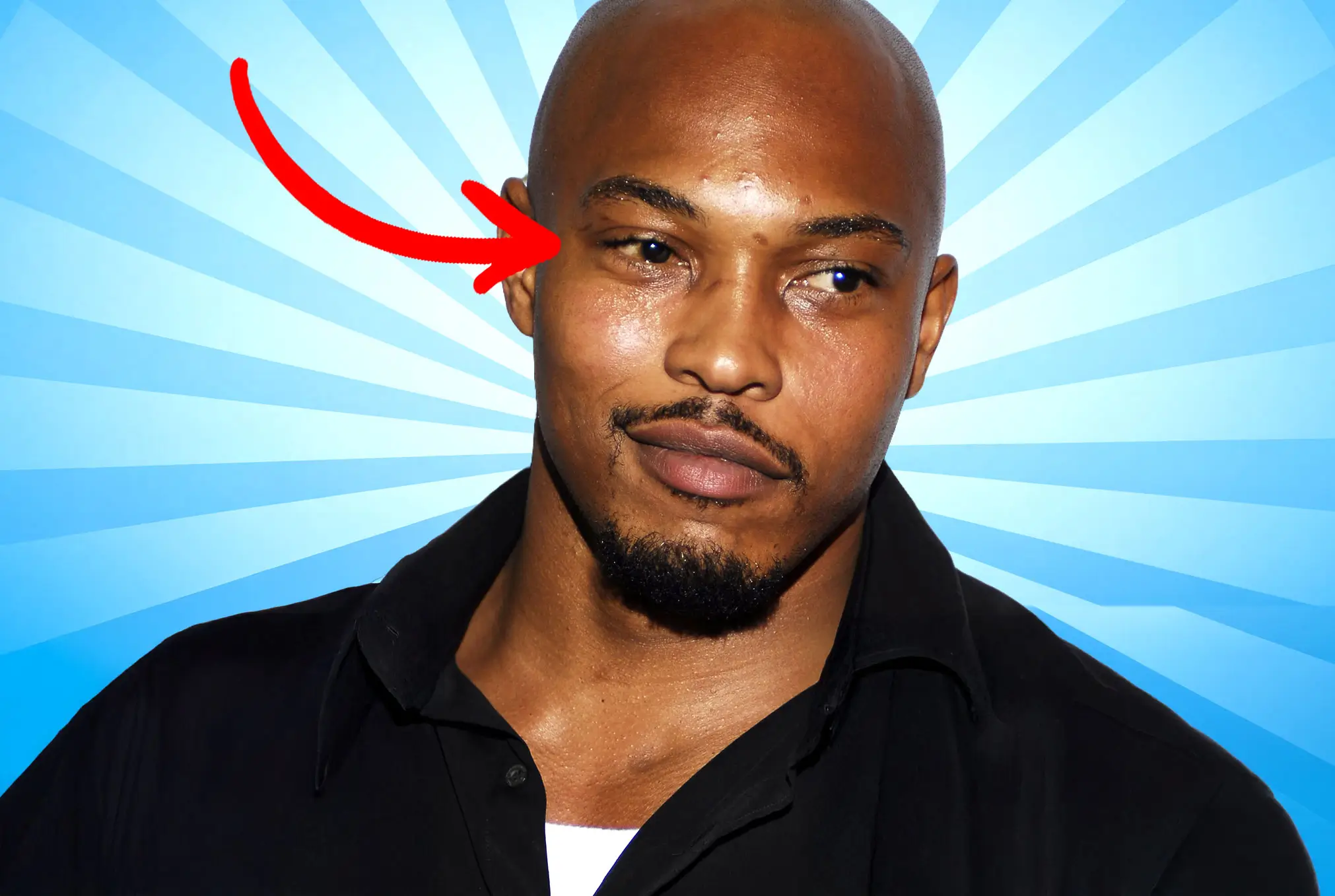 Sticky Fingaz lazy eye