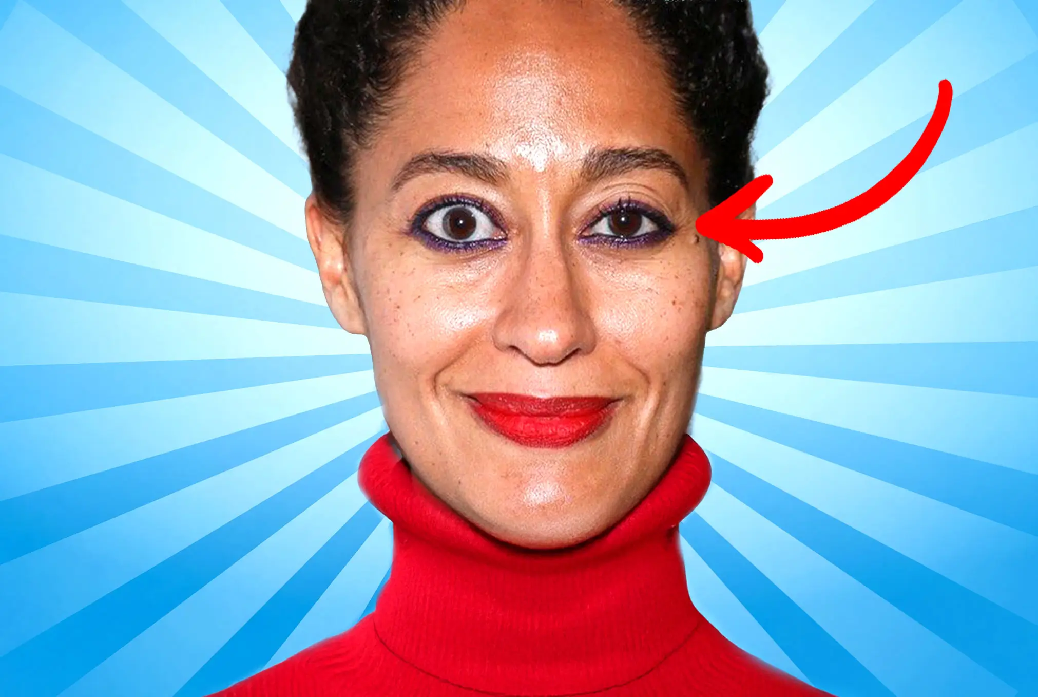 Tracee Ellis Ross lazy eye