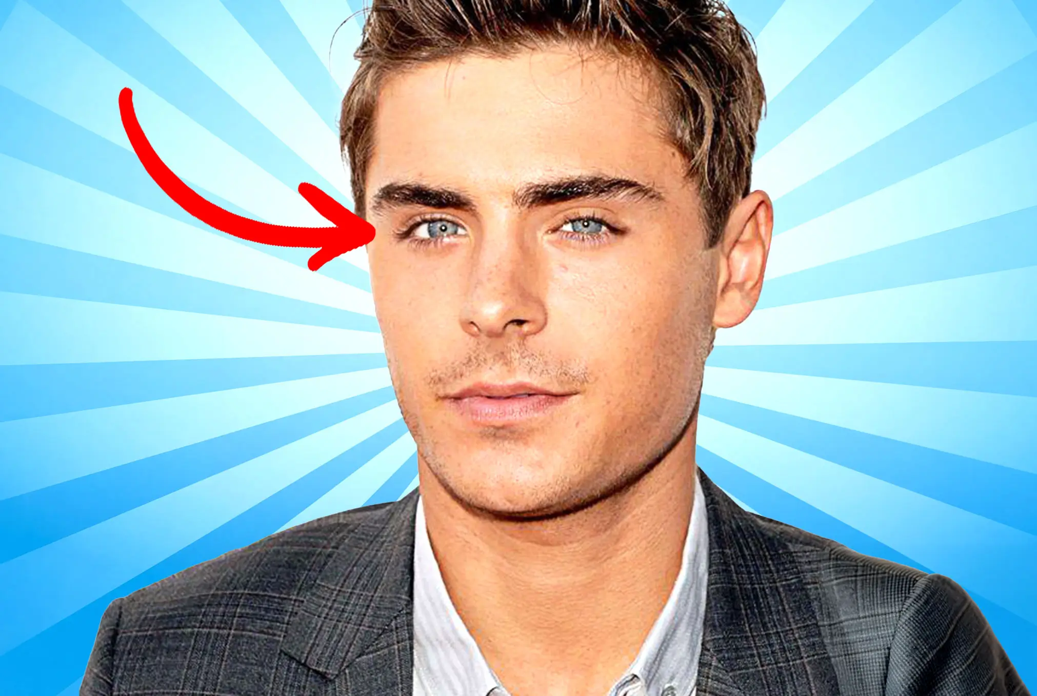 Zac Efron lazy eye
