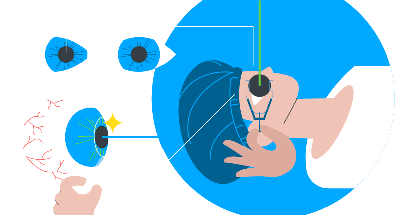 crossed eyes title image