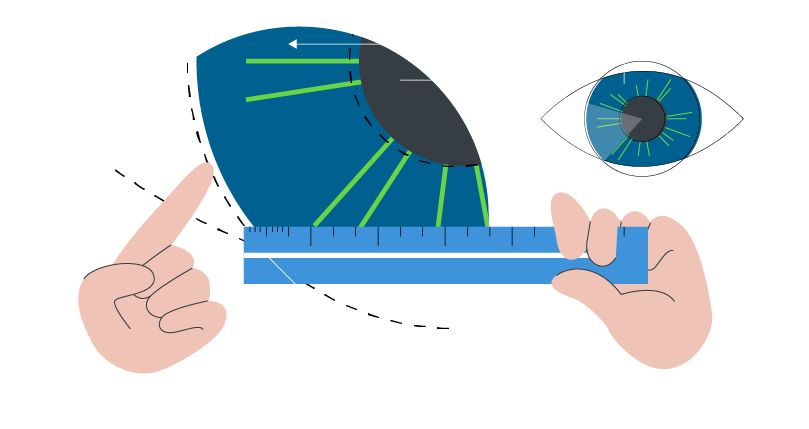 crossed eyes title image