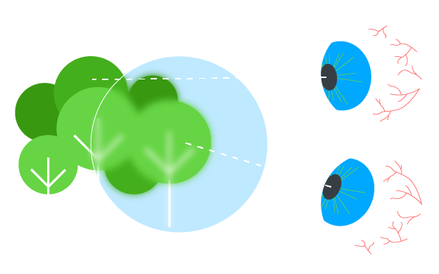strabismus the basics title image
